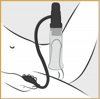 Voorbeeld: 2-in-1 penispomp en masturbator voor ultiem genot