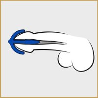 Voorbeeld: Penis Plug Sperma Anker